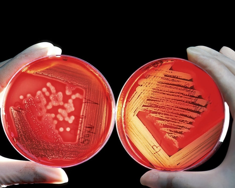 BIology culture plate